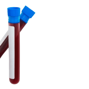 Electrolytes Test